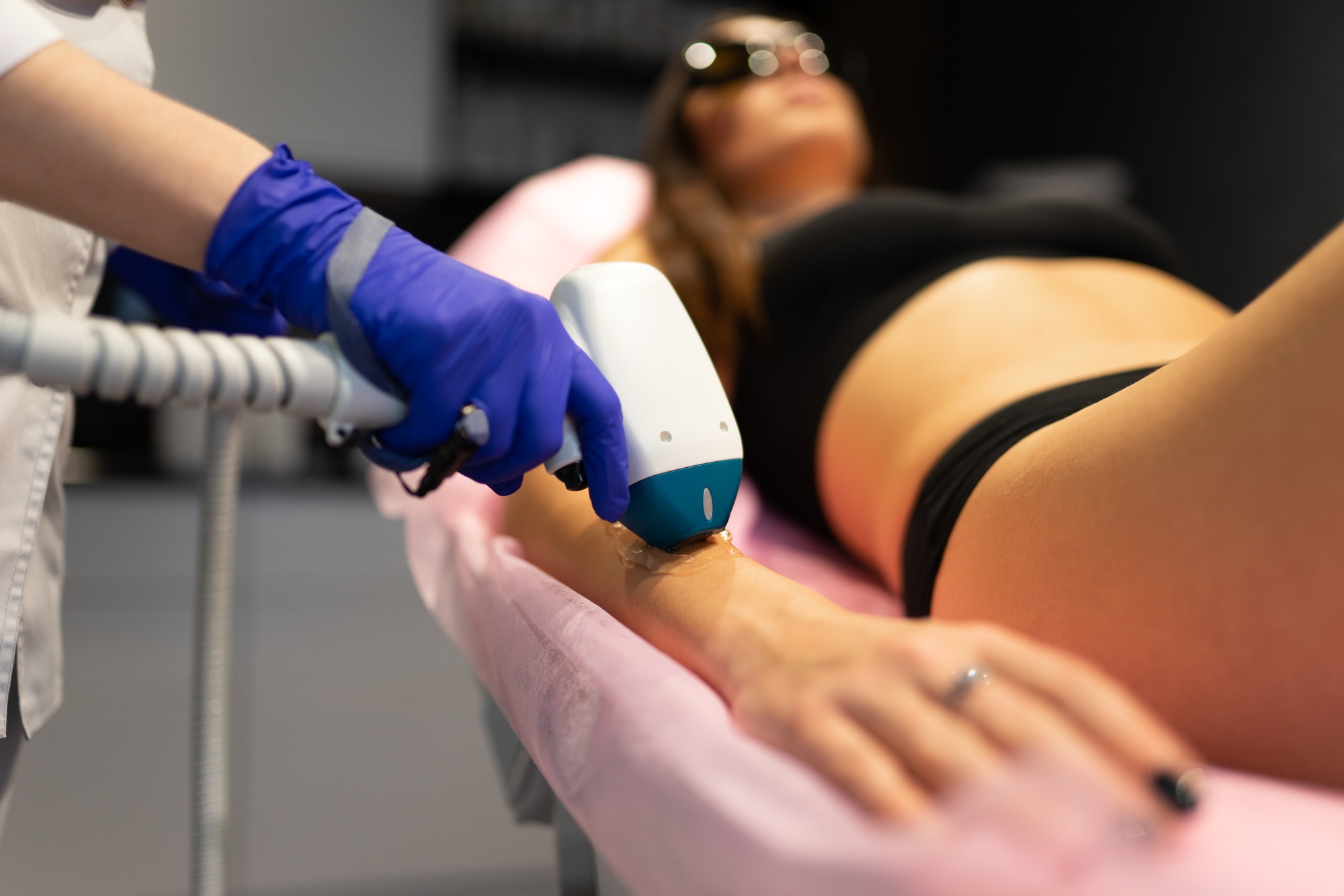 Beautician makes a laser hair removal procedure on patient hand